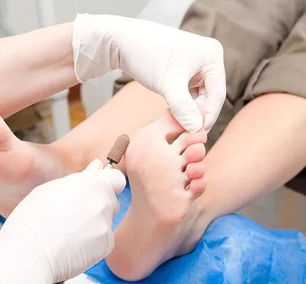 mobile podiatry services